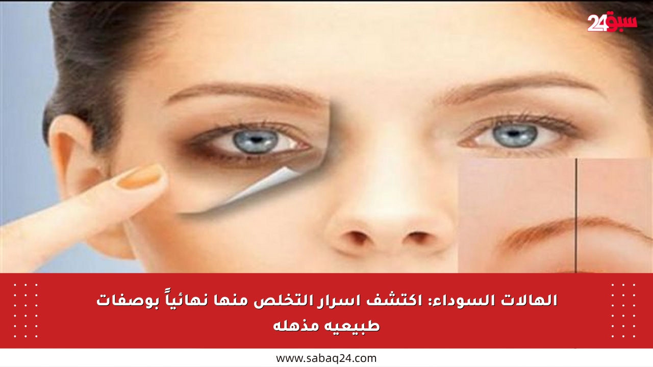 الهالات السوداء: اكتشف أسرار التخلص منها نهائياً بوصفات طبيعية مذهلة